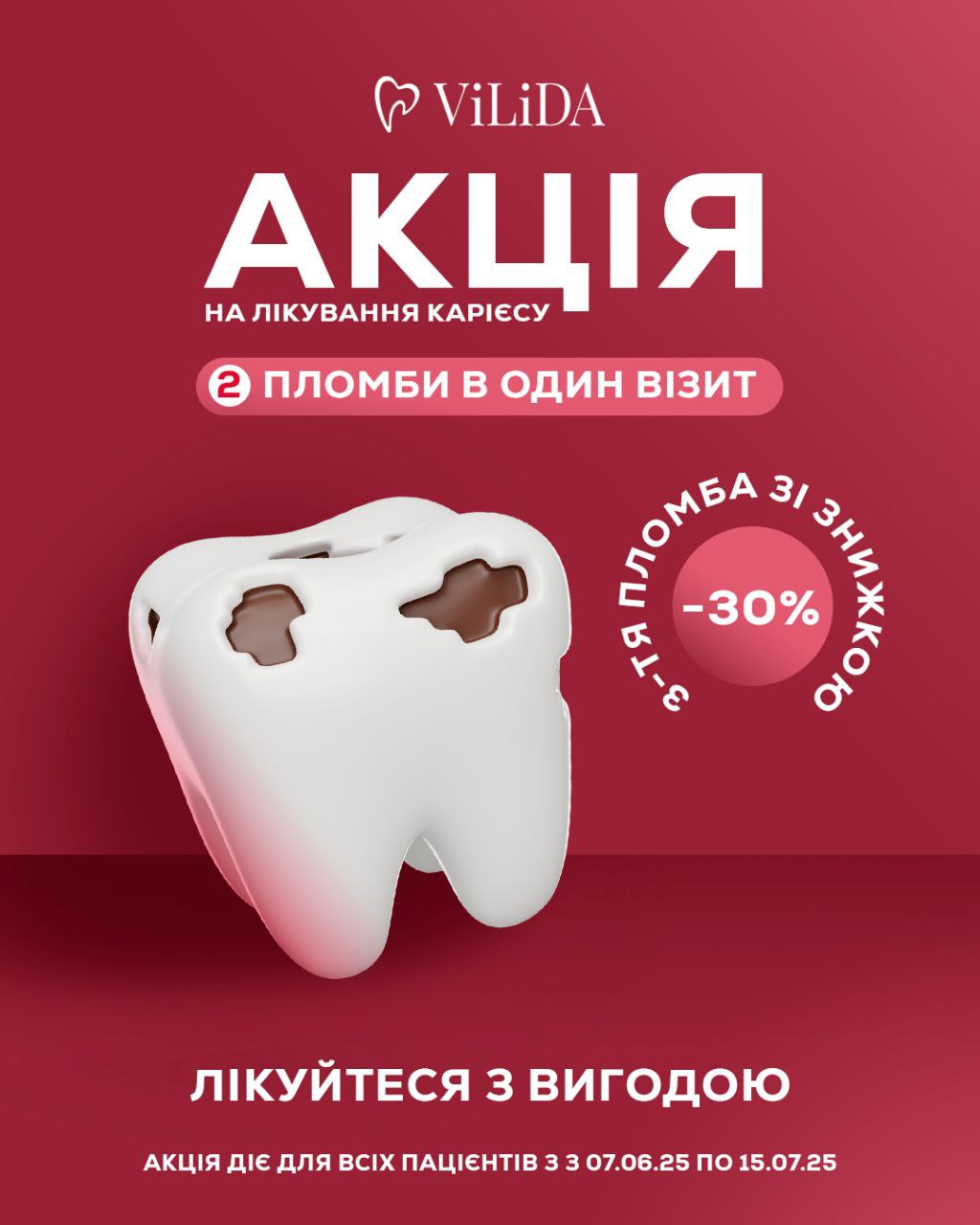 АКЦІЯ НА ЛІКУВАННЯ КАРІЄСУ У VILIDA